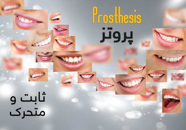 پروتز ثابت و متحرک دندان