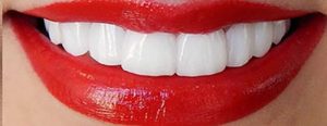 لمینیت دندان چیست