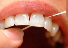 لمینیت دندان چیست
